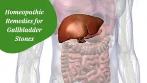 Homeopathic Remedies for Gallbladder Stones