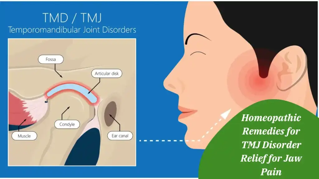 Homeopathic Remedies for TMJ Disorder Relief for Jaw Pain